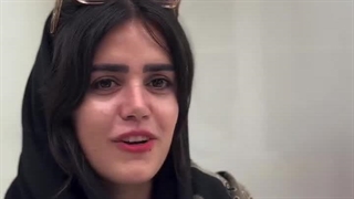 نتیجه عالی جراحی بینی بعد از یک سال