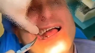 رفع نواقص فک با ارتودنسی