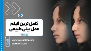 عمل بینی طبیعی و نچرال - پزشک 24