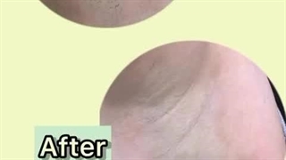 بهترین کلینیک لیزر در اهواز