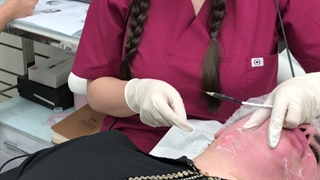 اندولیفت غبغب | کلینیک نچرال بیوتی