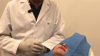 لیفت با نخ دوسوزنه سیلوئت آمریکائی