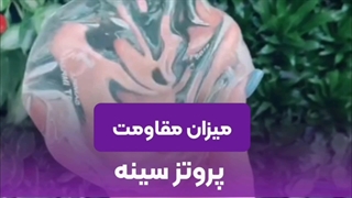 مقاومت پروتز