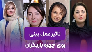 تاثیر عمل بینی روی چهره بازیگران