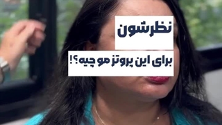 نصب پروتز بالاسری با قد ۵٠سانت