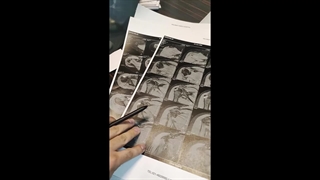 کوفتگی استخوان شانه