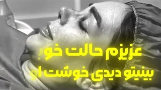 رضایت زیباجوی عزیز از تیپ پلاستی بینی در درمانگاه مسیح
