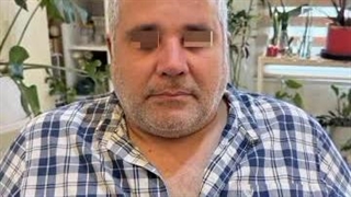 دو ماه پس از جراحی بینی