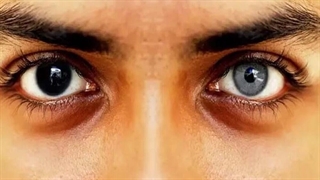 انجام این عمل جراحی ممنوع شد | عوارض خطرناک تتوی قرنیه چیست؟