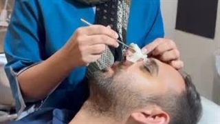 برداشتن گچ بینی