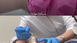 بهترین جراح بینی در رشت