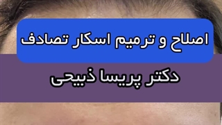 روند شگفت انگیز درمان اسکار تصادف از صفر تا نتیجه نهایی