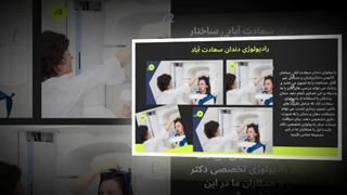 رادیولوژی دندان سعادت آباد برای ایمپلنت و جراحی فک