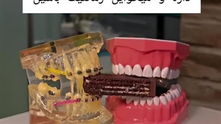 وقتی نامزدت ارتودنسی داره...