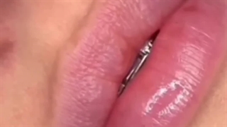 اصلاح فرم لب بدون تغییر شخصیت چهره | سبک نچرال کلینیک آی گل