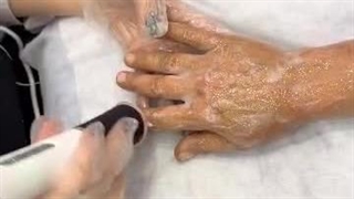 نمونه کار فیشیال دست در کلینیک دوما: تجربه‌ی جوانسازی و زیبایی دست‌ها