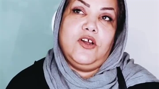 اصلاح افتادگی پلک؛ کوچک‌ترین جراحی، بزرگ‌ترین تأثیر