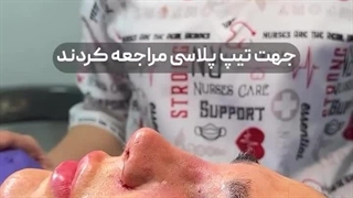 عمل تیپ پلاستی بدون بیهوشی درمانگاه مسیح