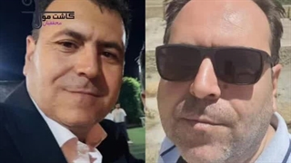 نمونه کاشت مو خانم محققیان