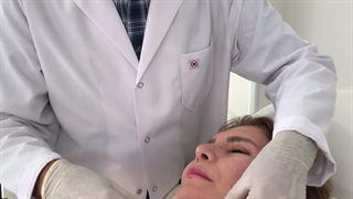 لیفت صورت با نخ