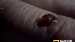 ساس چطور خون ما رو میخوره!!!