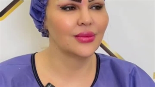 انجام همزمان بلفاروپلاستی و کاشت ابرو در کلینیک رنسانس