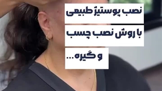 نصب پوستیژ طبیعی با روش چسب و گیره