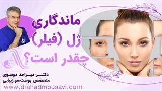 ژل (فیلر) چه مدت روی صورت دوام می‌آورد؟