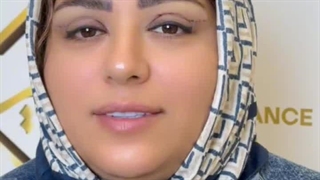 رضایت مراجعه کننده عزیز از انجام بلفاروپلاستی پلک