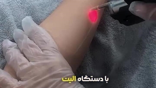 انواع خدمات کلینیک زیبایی ترنم