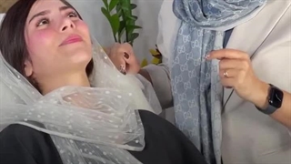 لیفت چشم و ابرو با بوتاکس