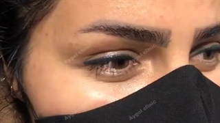 زیبایی همیشگی با کاشت حرفه‌ای ابروهای طبیعی