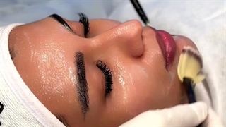 فیشیال پوست