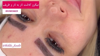 میکروکاشت ابرو