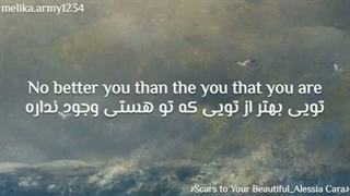 ورژن اصلی آهنگ scars to your beautiful از آلسیا کارا